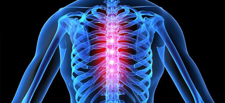 Exacerbácia osteochondrózy hrudnej chrbtice