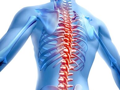 lézie chrbtice s osteochondrózou