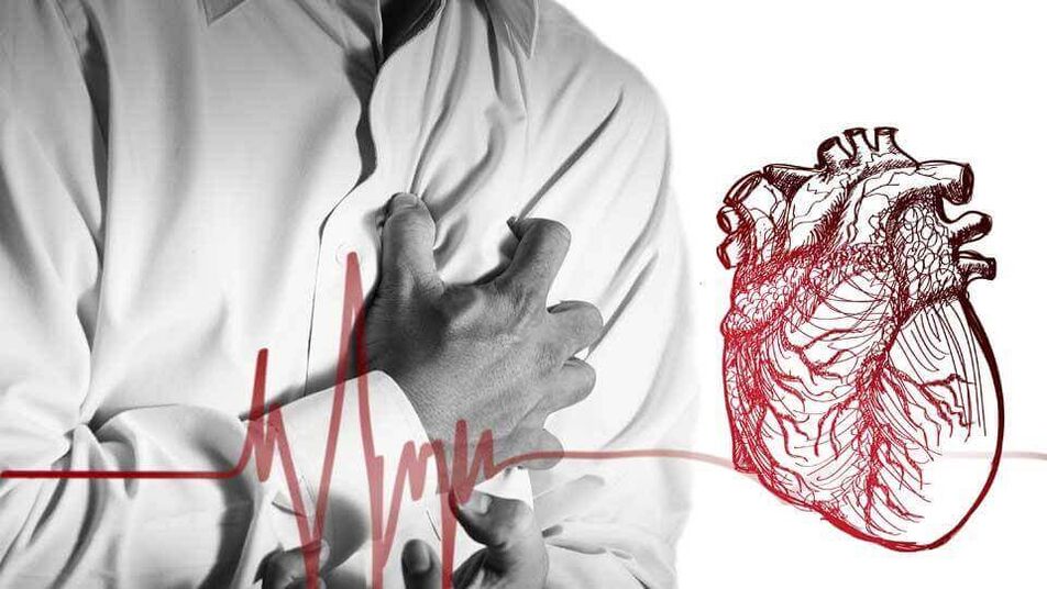 V dôsledku narušeného srdcového rytmu pri hrudnej osteochondróze sa môže vyvinúť extrasystol