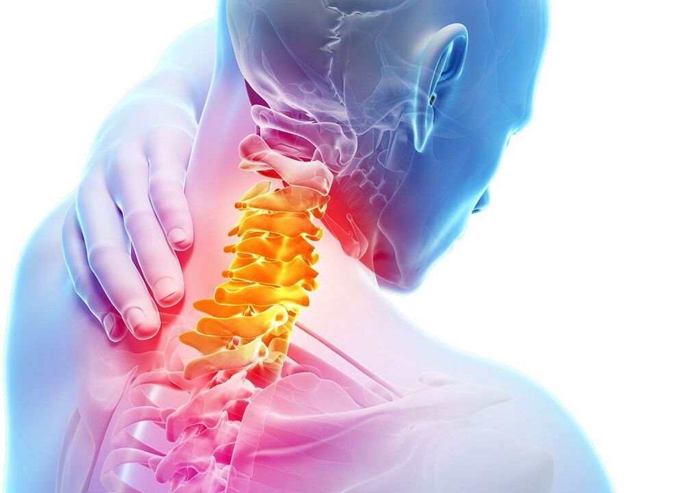 príznaky osteochondrózy chrbtice