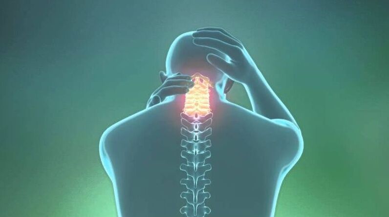 Osteochondróza krčnej oblasti