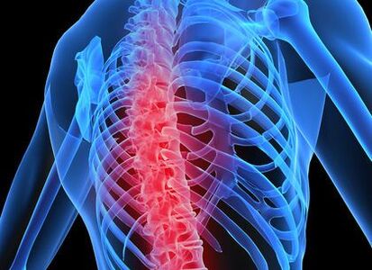 osteochondróza hrudnej chrbtice