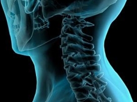 metódy diagnostiky cervikálnej osteochondrózy